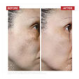 Dr. LEVY Skin Reset Treatments Radical³ Reboot Pro Peel 50 ml