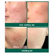 Some By Mi AHA.BHA.PHA 30 Days Miracle Acne Clear Foam 100 ml